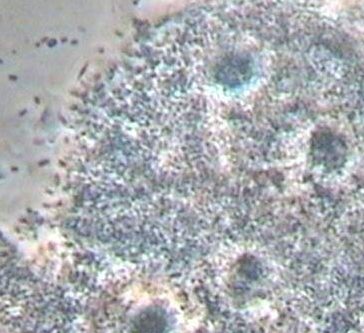 全自動白帶草莓视频污新地址廠家分析線索細胞感染的緣由