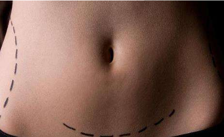 正常陰道分泌物的異常分泌物有哪些類型？