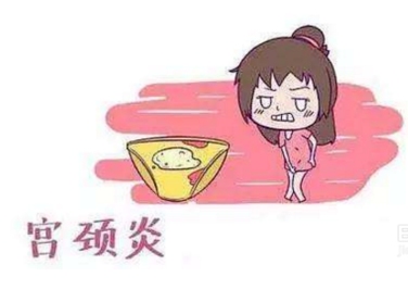 婦科白帶草莓视频APP免费廠家分析宮頸炎的症狀