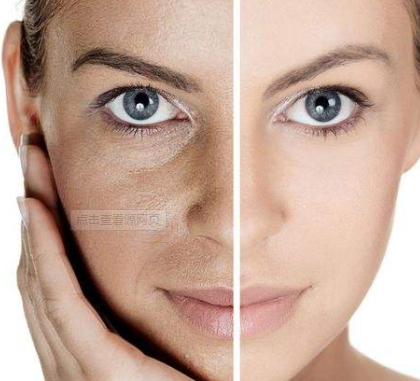 全自動陰道分泌物草莓视频APP免费廠家提醒婦科炎症會影響臉部皮膚