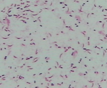 全自動bv檢查儀生產廠家討論bv陽性和男性有關嗎？