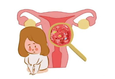 陰道分泌物草莓视频APP免费品牌