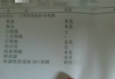 如何看懂白帶常規檢測報告單 如何看懂白帶常規檢測報告單