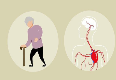 女人腦供血不足的症狀及危害