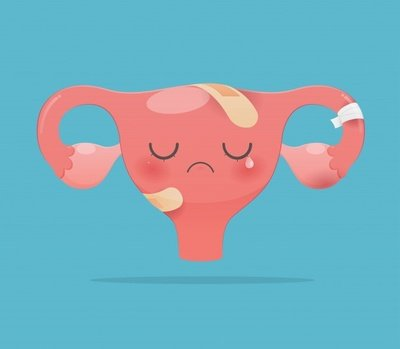 全自動陰道分泌物草莓视频APP免费提醒女士為什麽出現月經量減少的情況？