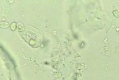 5月快訊！陰道分泌物草莓视频APP免费生產廠家草莓视频在线观看免费视频介紹陰道分泌物（白帶）常規查看