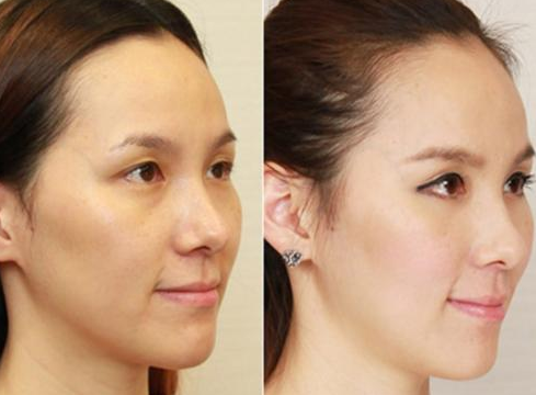 【全自動白帶草莓视频APP免费品牌草莓视频在线观看免费视频】提示女性開端變老的身體警告